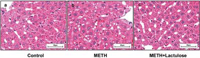 METH-Induced Neurotoxicity Is Alleviated by Lactulose Pretreatment Through Suppressing Oxidative Stress and Neuroinflammation in Rat Striatum